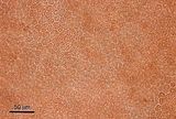 3 -Cellule corticali in visione superficiale
